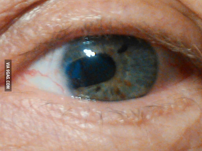 A broken iris. I guess he was... IRISponsible. - 9GAG
