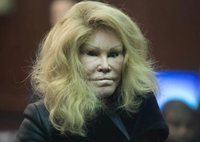 Socialite Jocelyn Wildenstein catwoman Is Living On 900 A Month 