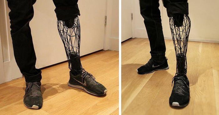 3D-scanned and printed Exo prosthetic leg made from titanium, designed ...