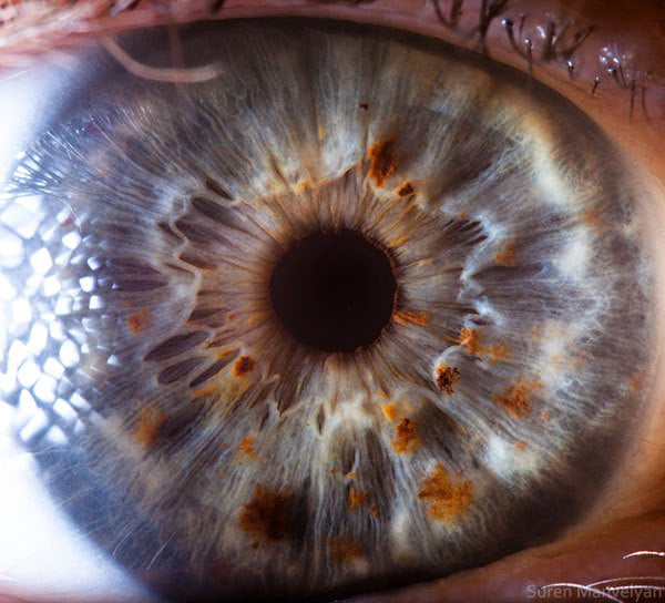 Фото радужки краснодар цена Different Colored Eyes Have Different Textures: Here's a Close Up of a Blue Eye 