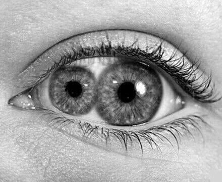 polycoria double pupil eye