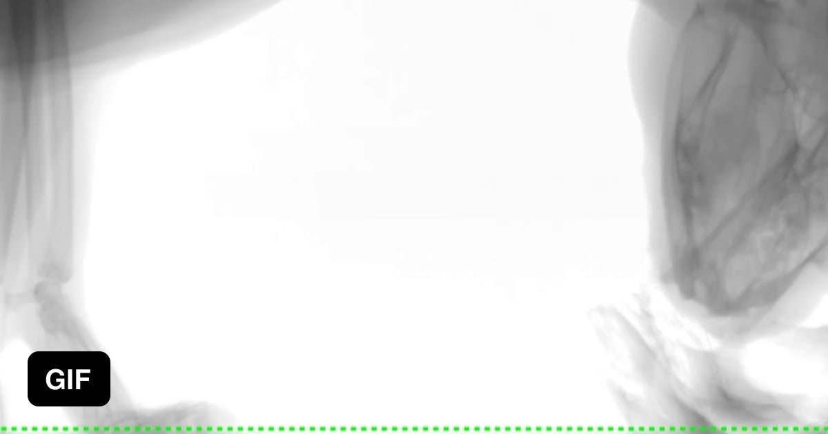 X Ray Of A Cat Eating Food 9GAG x-ray-of-a-cat-eating-food-9gag