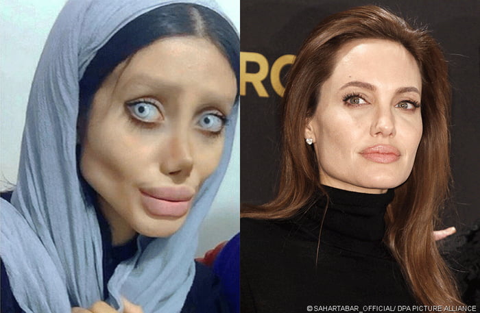 29 years old Sahar Tabar from Iran undergoes 50 (!) plastic surgeries ...