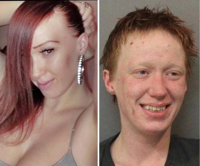 Meth Is A Helluva Drug Before After Only 2 Years Apart Don T Do Drugs 9gag