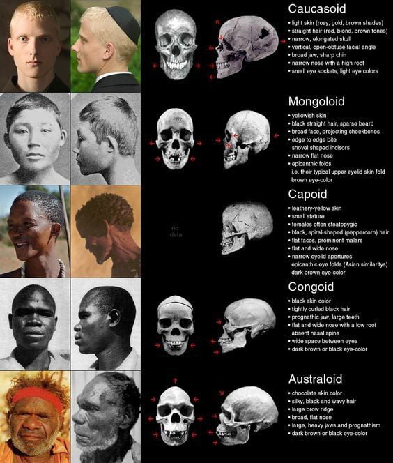 Different Human Skulls By Race Caucasian And Asian Share Similiar Bone