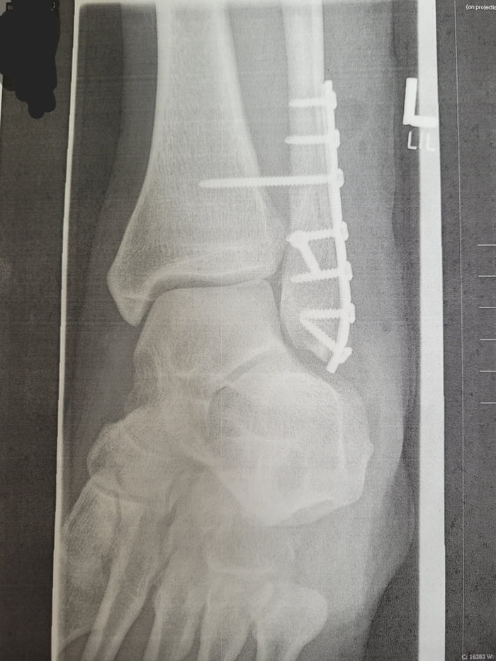 Show your f****d up xrays 9GAG