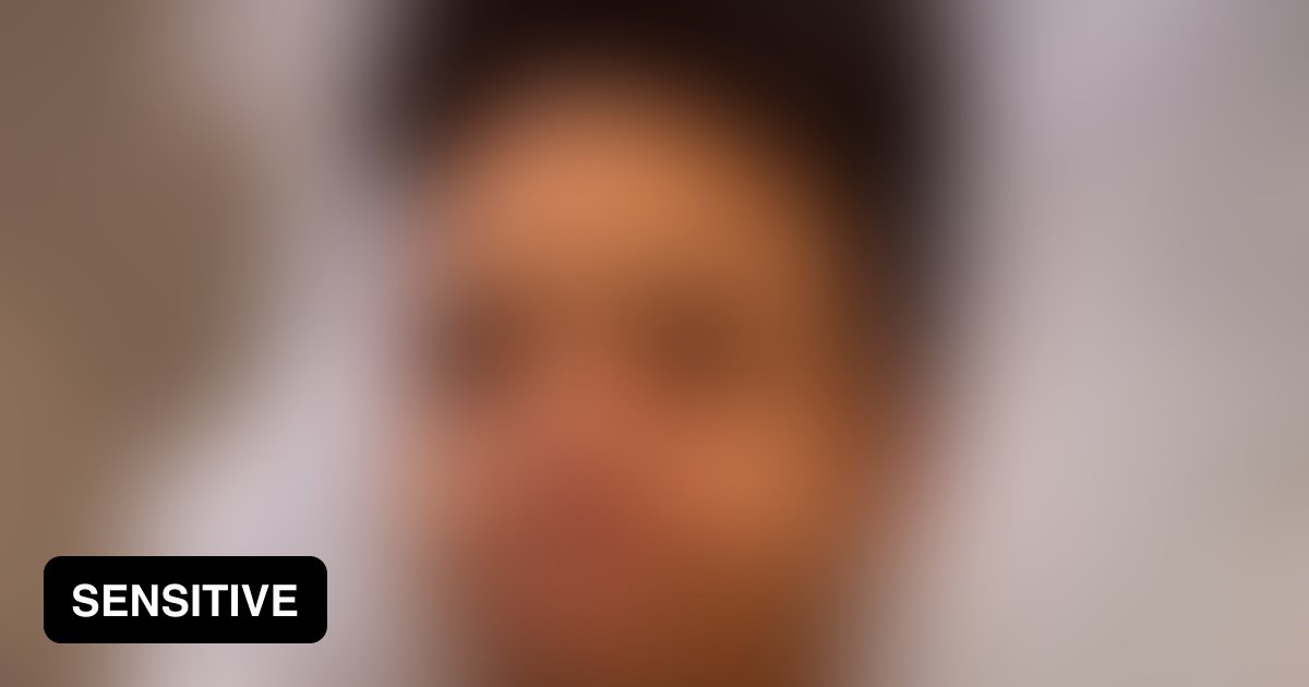 College Basketball Star Says His ‘Balls Exploded’ Suddenly 9GAG