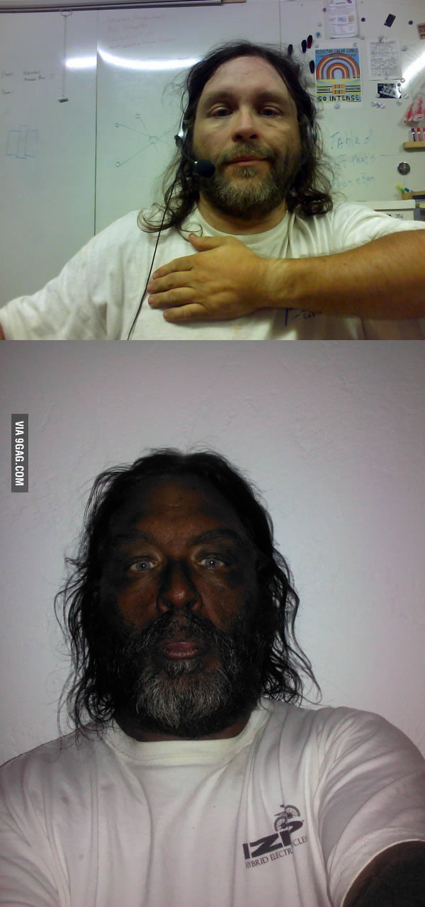 Before and after photos of a man injecting himself with Melanotan II ...