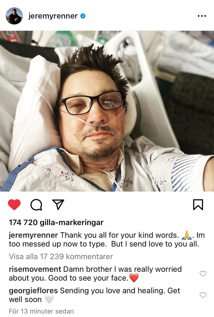 Jeremy Renner, 2 days after being runover by a snow cat. Happy he seems