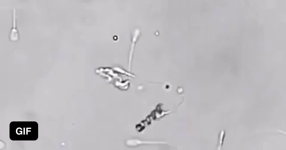 A nanobot helping a sperm with motility issues along towards an egg ...