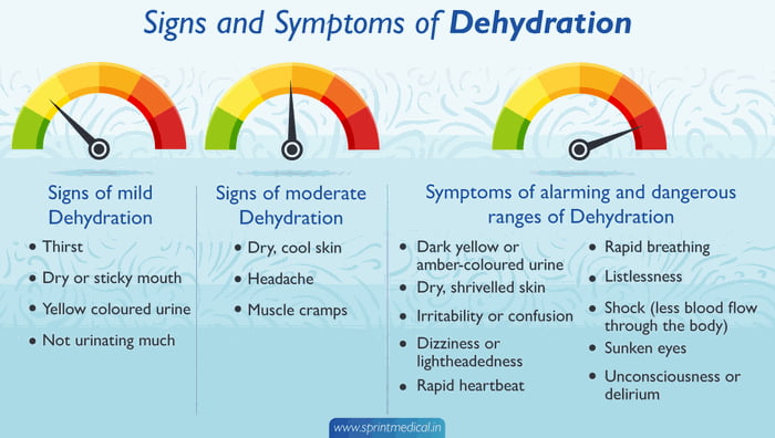 Symptoms Of Different Levels Of Dehydration R Infographics