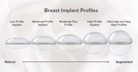 I'm buying my girlfriend new ultra high profile implants for her ...