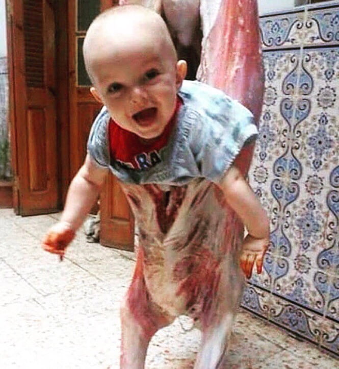 A Rare Image Of A Baby With Harlequin Syndrome 9gag