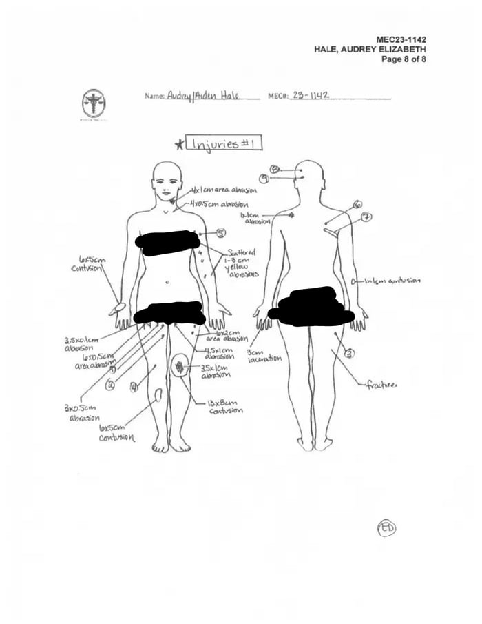 Even as she identified as Male, the doctor still used the Female model