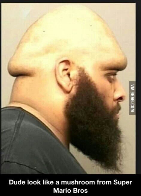 Dude looks like 9GAG