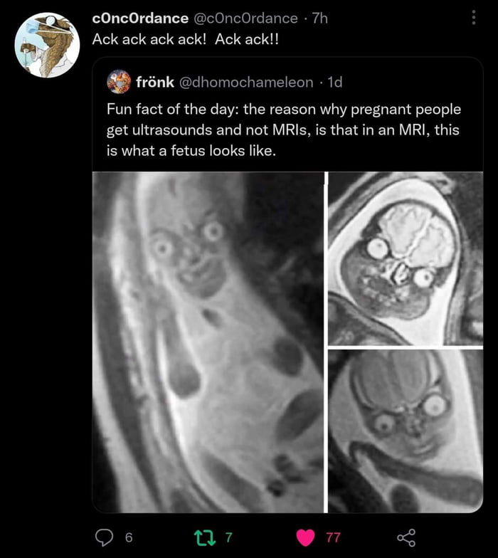 MRI - 9GAG