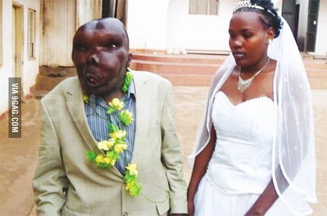 Meet The World S Ugliest Man And He Is Better Than You With Women