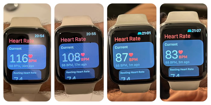 Stressful heart rate after splashing water on face, 5 min timed ...