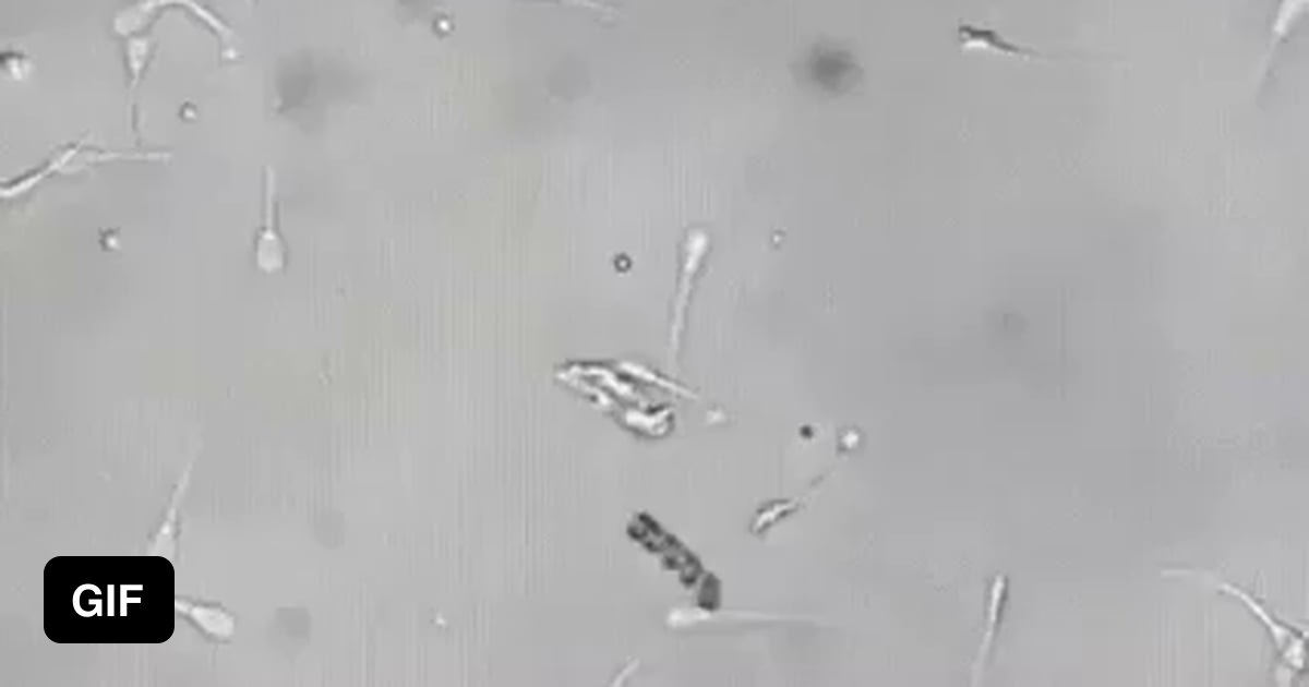 Welcome to the age of nanobots: Here, a nanobot picks up a lazy sperm ...