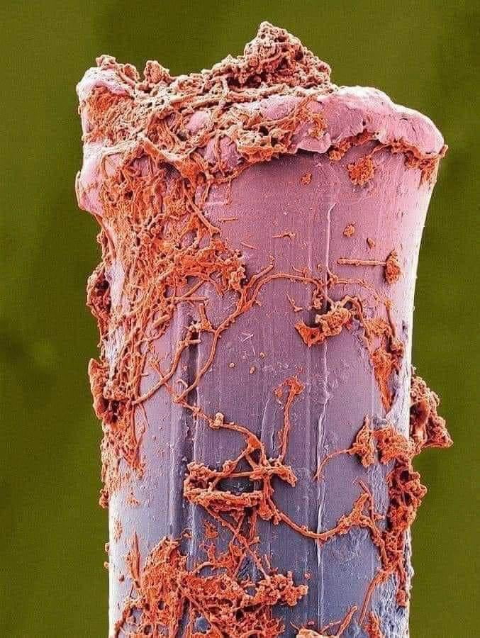 Used Toothbrush Microscope A used toothbrush bristle under an electron microscope. - 9GAG