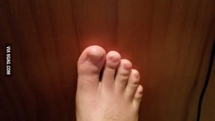 To The Girl With 4 Toes And The Guy With 6 I Have 5 9gag to the girl with 4 toes and the guy