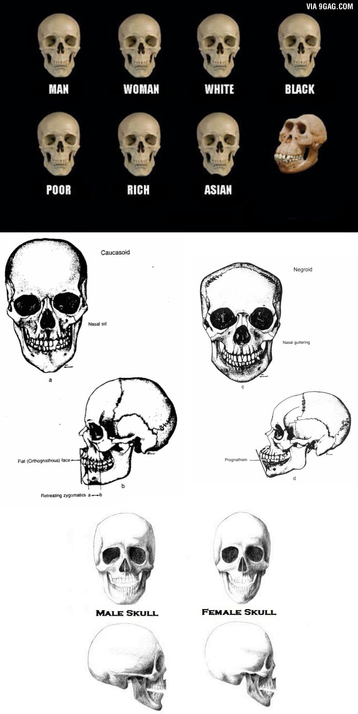 To everyone posting this picture how there are no racial differences in ...