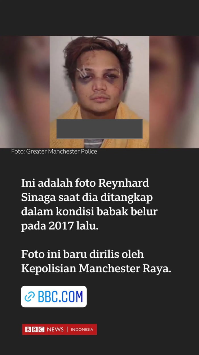 Jir abis jilat puting / cipok cipok basah korbannya dibuat bengep - 9GAG