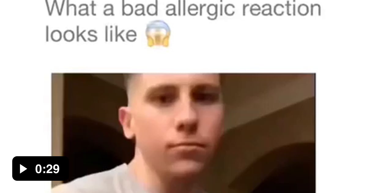 a-dangerous-allergic-reaction-9gag