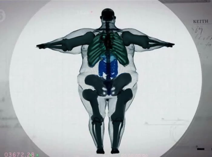 How people think they look in an x-ray when they say they are big boned ...