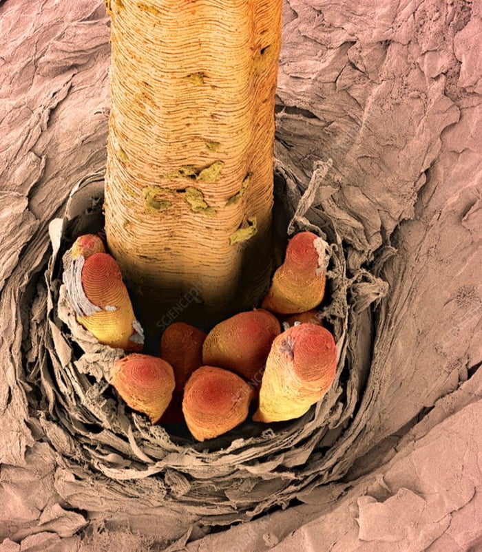 Mites Crowding Around A Single Eyelash Follicle Magnified At 170 9gag