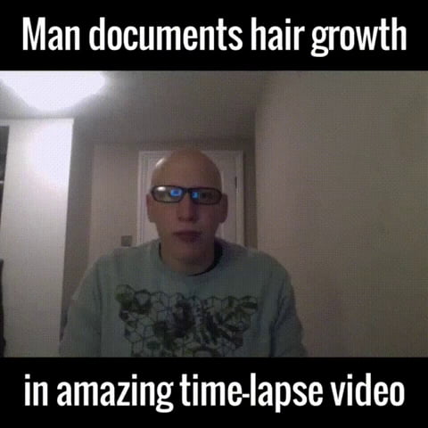 Hair Growth Time Lapse 9gag