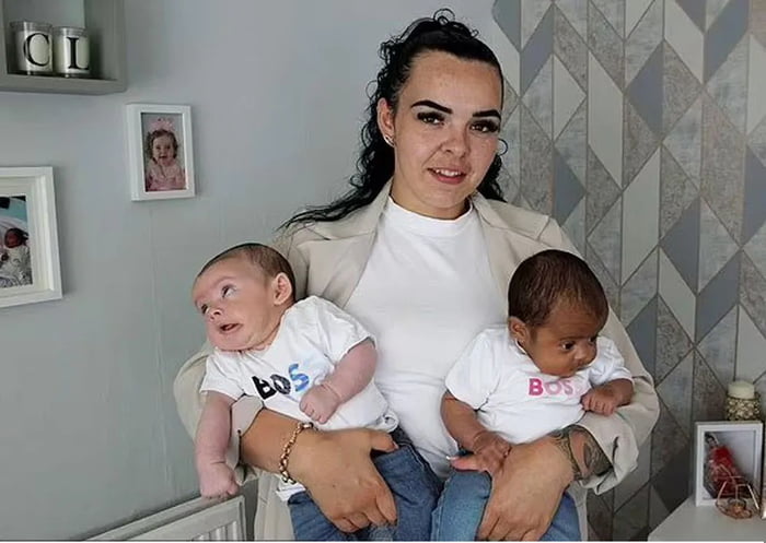 Woman in Britain gave birth to twins one white, green eyed child and ...