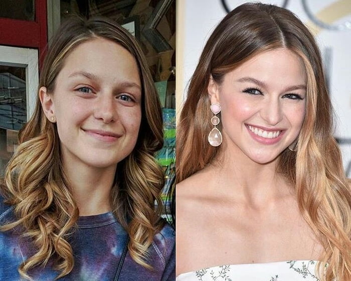 Melissa Benoist Comparison - 9GAG