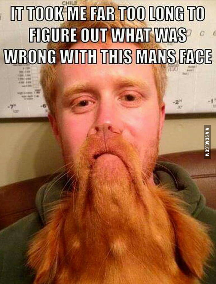 What's wrong with his face? - 9GAG