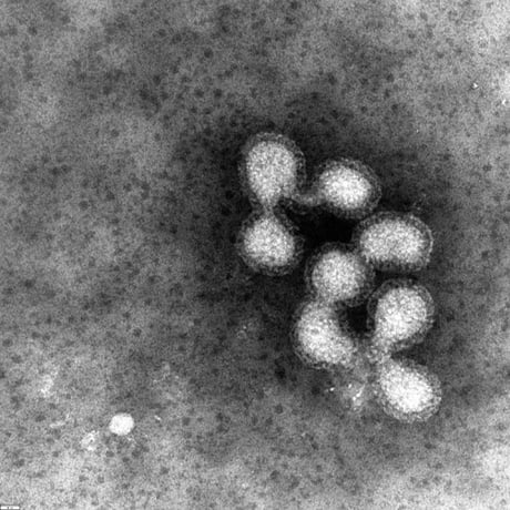 Influenza Virus Flu Under Microscope Micropedia