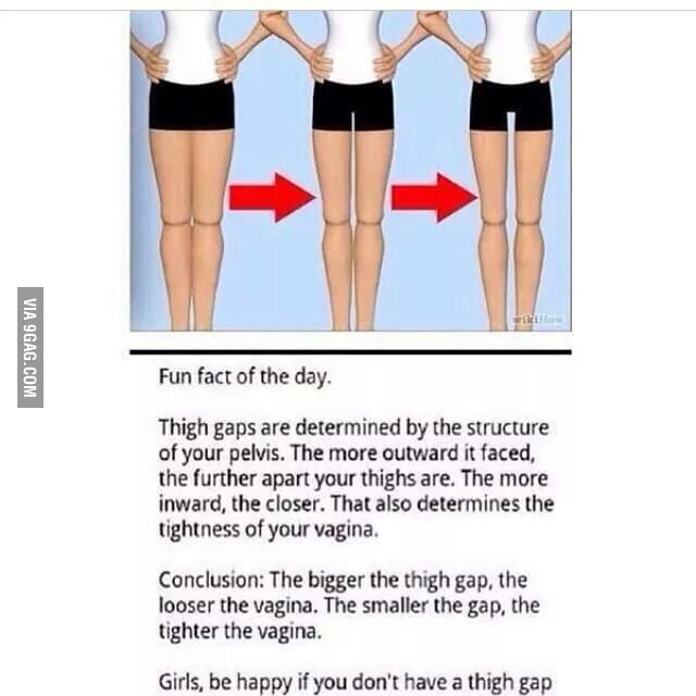 Still think those sought for thigh gaps are sexy? 