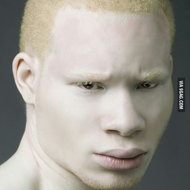 black-albino-where-s-your-god-now-9gag