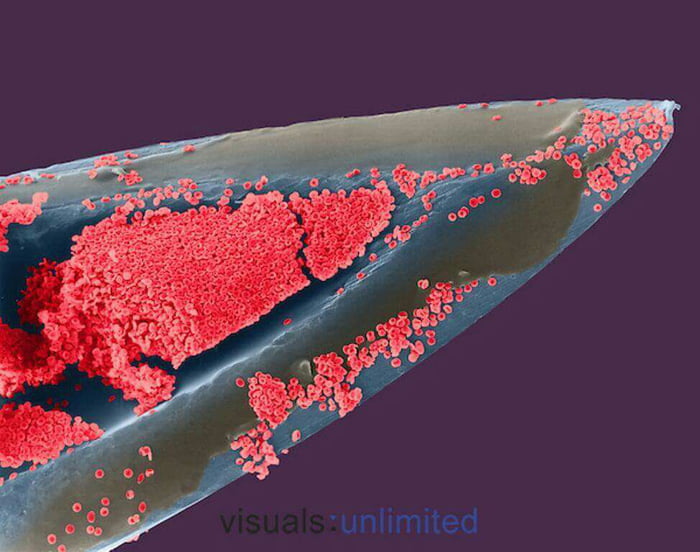 A needle under a powerful microscope. Notice the blood cells and the