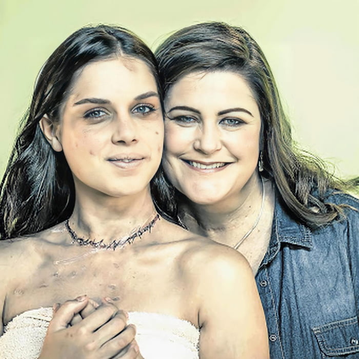 Alison Botha (left), Was Abducted, Assaulted, Stabbed 30 Times ...