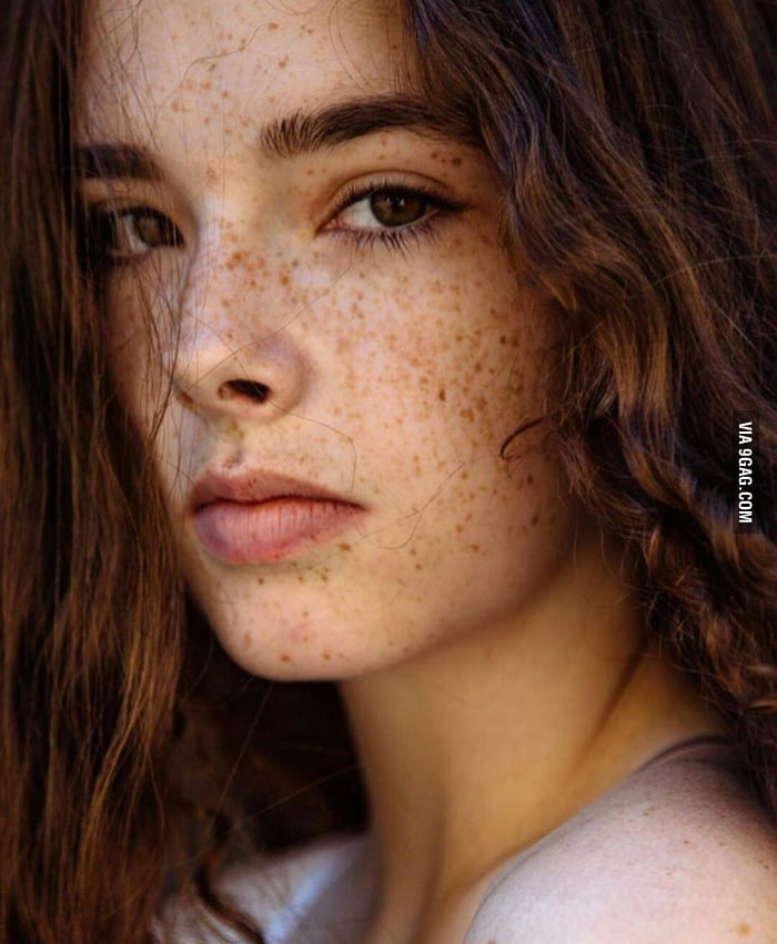 To everyone who says that freckles are disgusting, no, I think it makes ...
