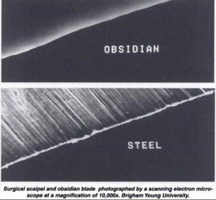 Steel Vs Obsidian Surgical Blades Under An Electric Scanning Microscope