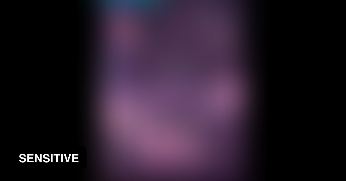 Giant LED TV screen falls atop of a performer. Currently in critical