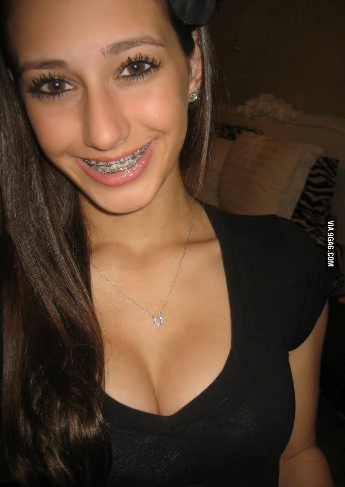 Girls With Braces Are Quite Sexy Gag