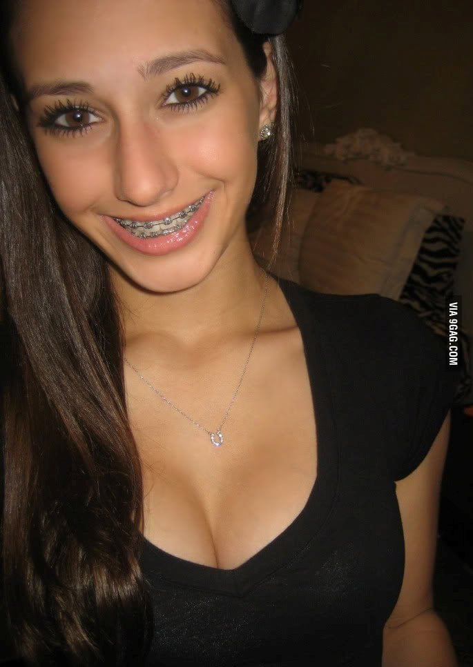 Girls With Braces Are Quite Sexy 9gag