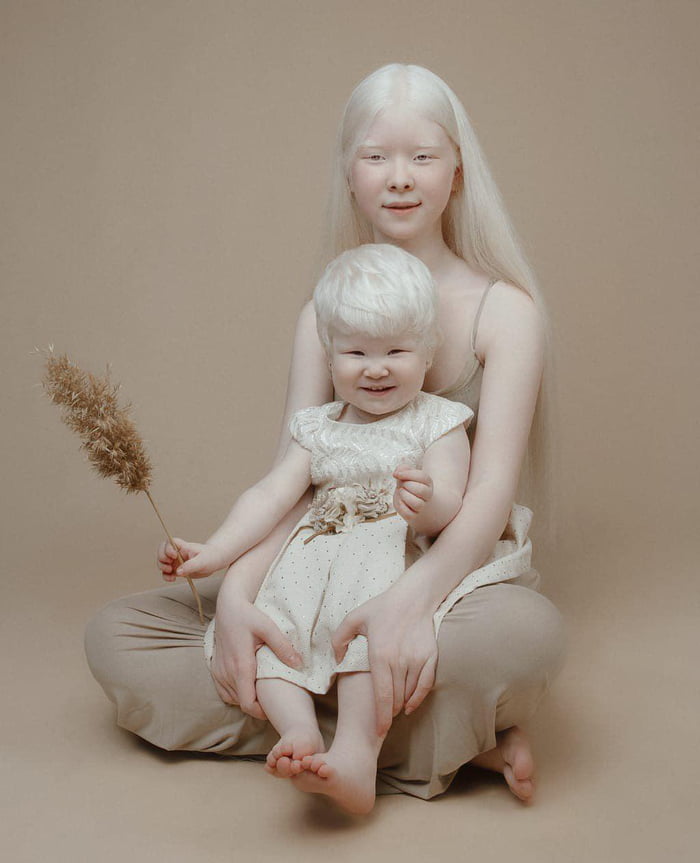 Asel and Kamilia Kalaganova - the Kazakh albino sisters. - 9GAG
