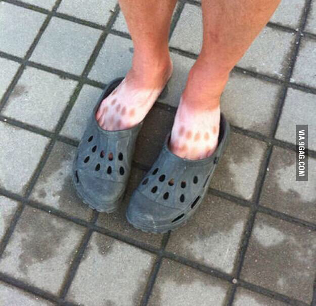 Croc Spots - 9GAG