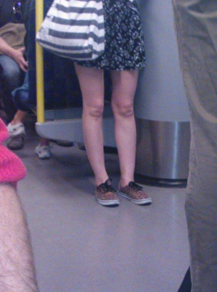 "Baby face" knees 9GAG