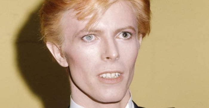 David Bowie didn’t have two different coloured eyes, but two different ...